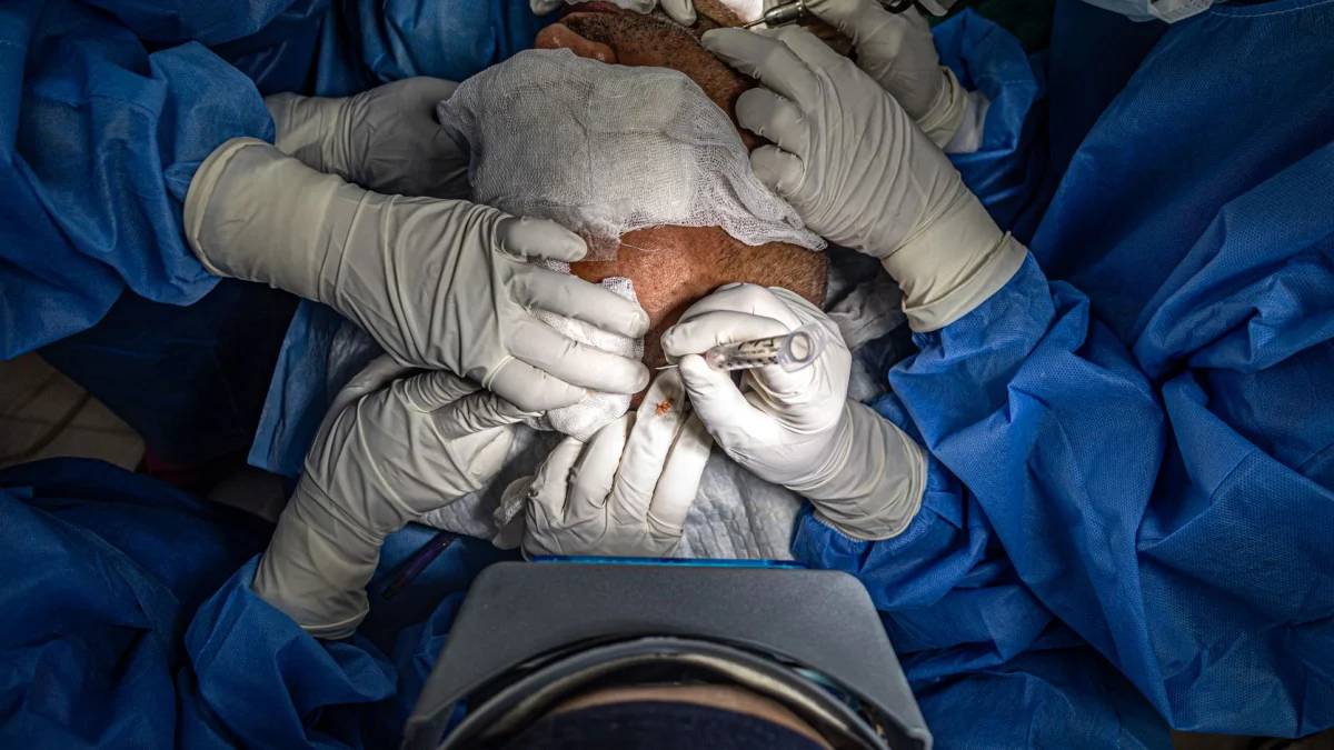 Chirurgen in een operatiekamer voeren een nauwkeurige medische procedure uit onder steriele omstandigheden.